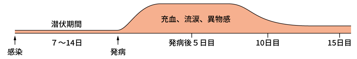 感染から発病、発病後5日目・10日目・15日目までの症状の図